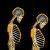 Osteoporóza